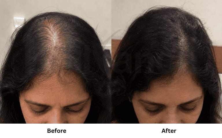 महिला बाल विकास Before After परिणाम